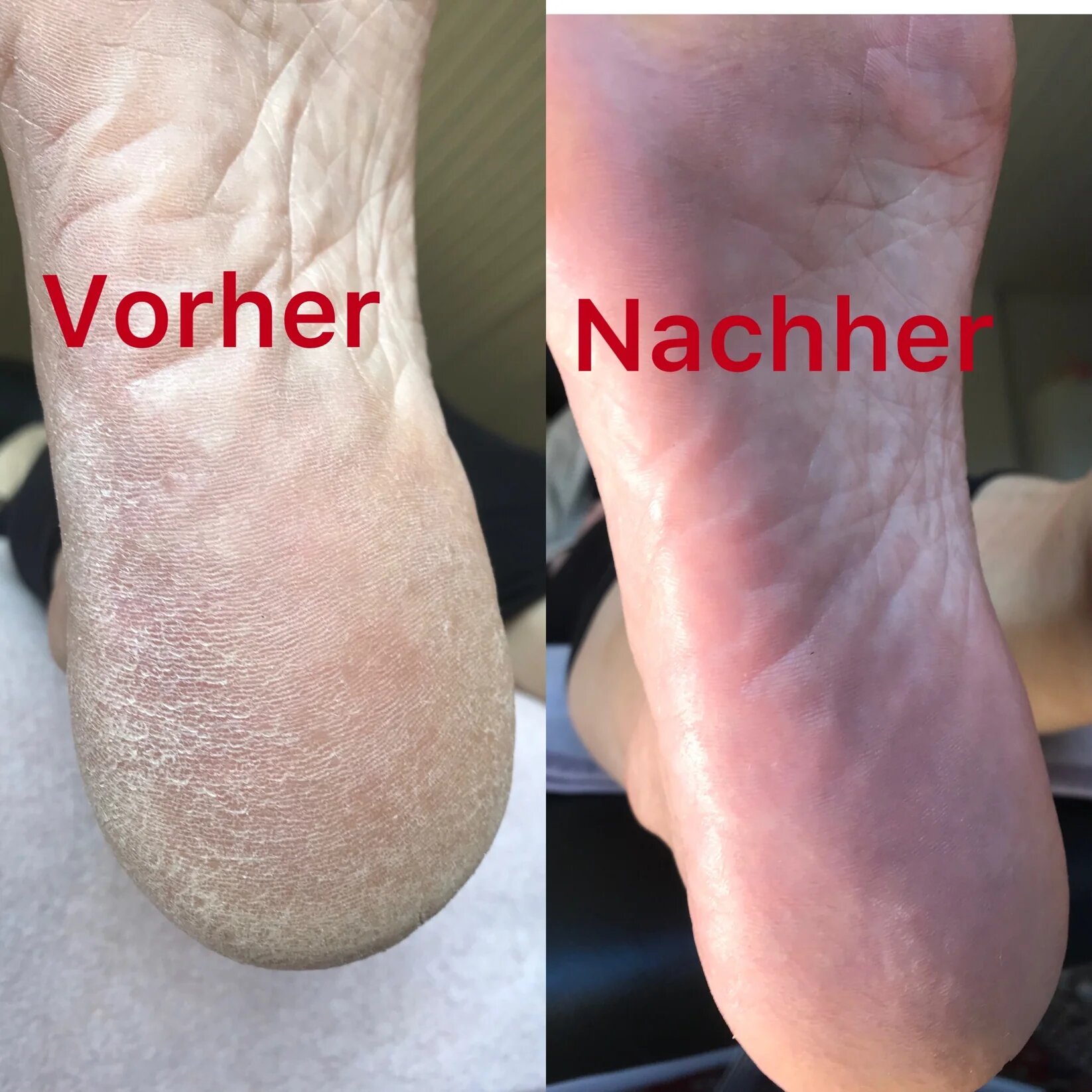 „Professionelle Fußpflege zur Förderung der Fußgesundheit in Hannover“