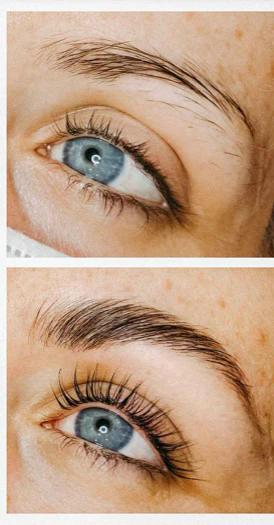 Brow-Lifting bei Elsa Cosmetic Hannover – Augenbrauen werden fixiert und volumisiert