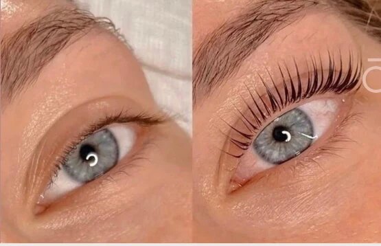 „Vorher-Nachher Ergebnis eines Lash-Liftings bei Elsa Cosmetic Hannover“