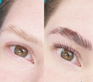 Brow-Lifting bei Elsa Cosmetic Hannover für perfekt geformte Augenbrauen